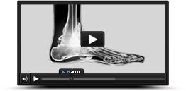 Multimedia Educatoin Videos Aaron M. O,Brien, MD - Orthopedic Foot & Ankle Surgeon